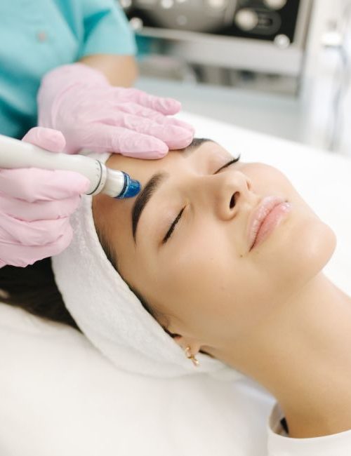 dermapen-alcala-henares–00 dermapen-alcala-henares--00