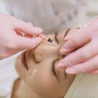 tratamientos-faciales-doctora-pezua--11